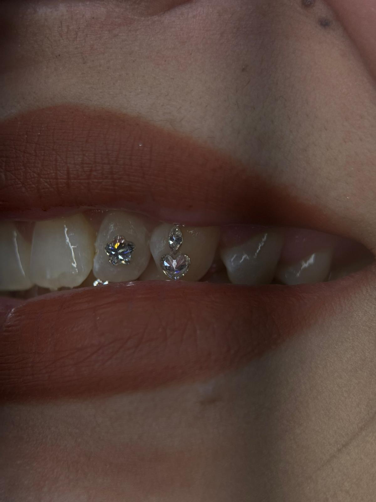 Micro zirconia