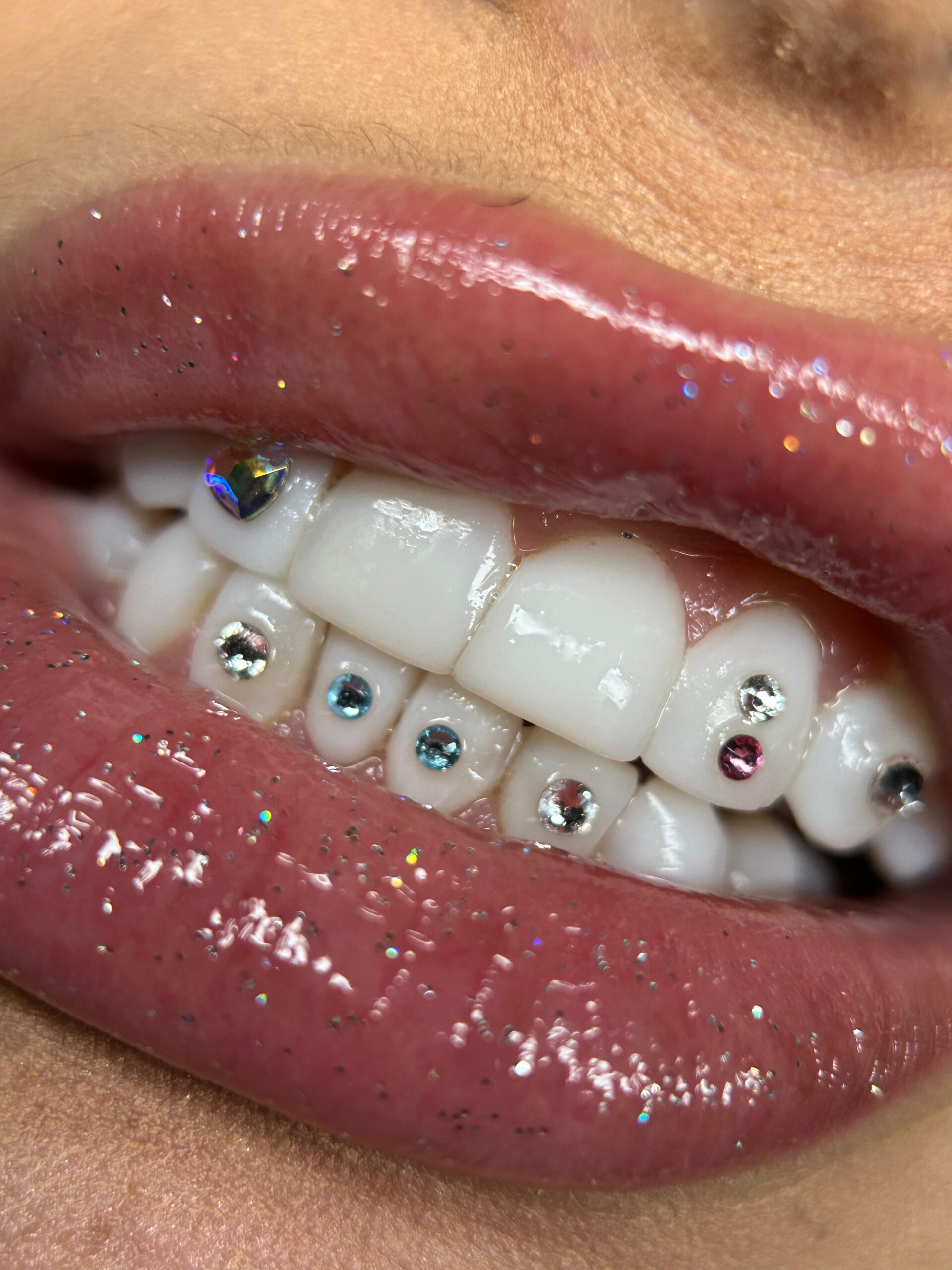 Swarovski Round gemas dentales