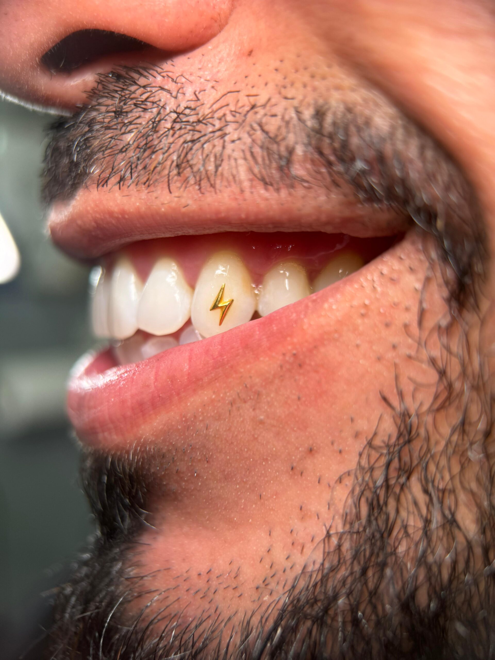 Oro 18k dental